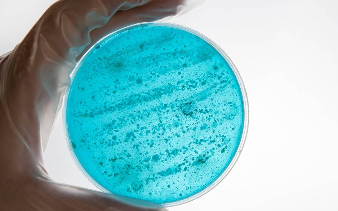 Planes de mantenimiento preventivo contra la Legionella