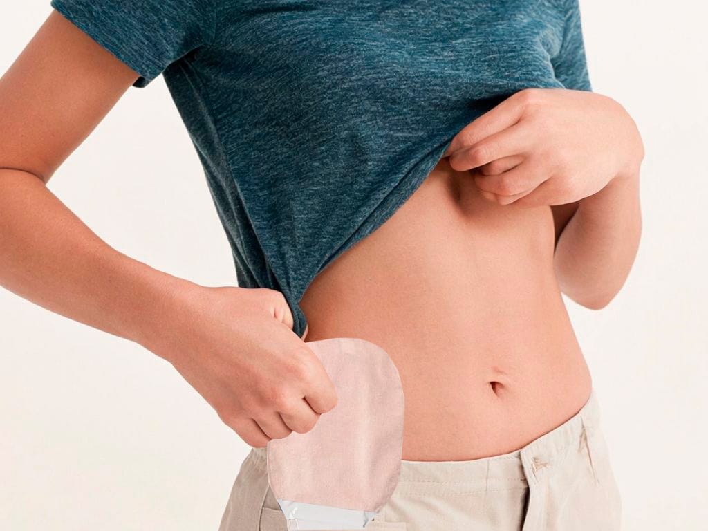 Gestión de residuos para personas ostomizadas