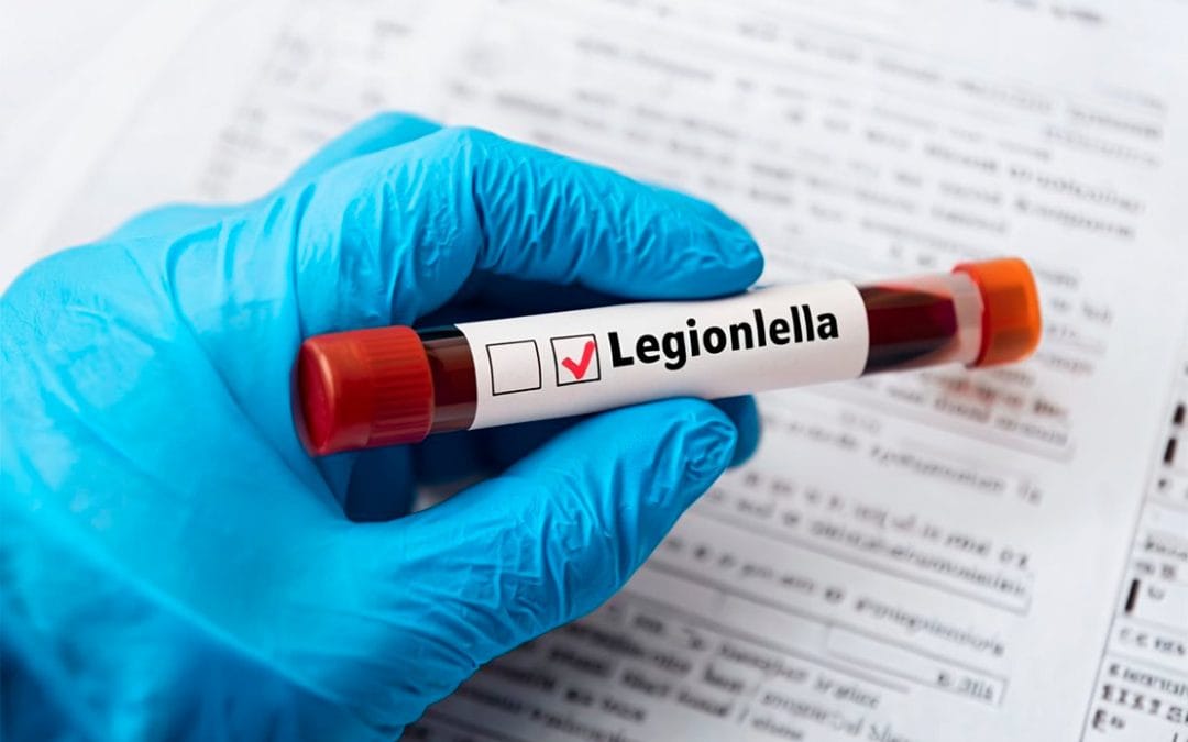 Control de Legionella en Lugo
